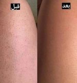 نمک بدن هلو بیواکوا اورجینال - تصویر 2