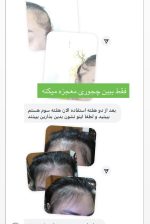 پک ویال مو رشد مو و ضدریزش پروتئینه مو اورجینال - تصویر 3