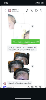 پک ویال مو رشد مو و ضدریزش پروتئینه مو اورجینال - تصویر 2