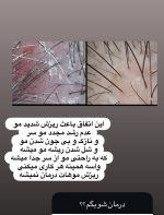 اسکراب کف سر - تصویر 4
