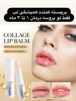 فیلر لب جذبی کلاژن - تصویر 2