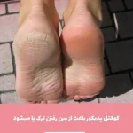 کوکتل پدیکور پا - تصویر 3