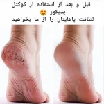 کوکتل پدیکور پا - تصویر 2