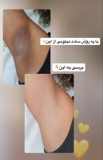 اسکراب لایه بردار رفع تیرگی کوجیک اسید و زردچوبه - تصویر 7