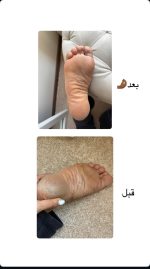 اسپری پیلینگ پا(ترک پا) اورجینال - تصویر 3