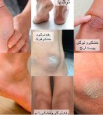 کرم ترک و خشکی پا ووکالی اورجینال - تصویر 4