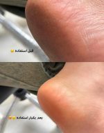 کرم ترک و خشکی پا ووکالی اورجینال - تصویر 3