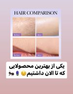 اسپری روغن و عصاره حذف مو روغن مورچه صدرصد اورجینال - تصویر 6