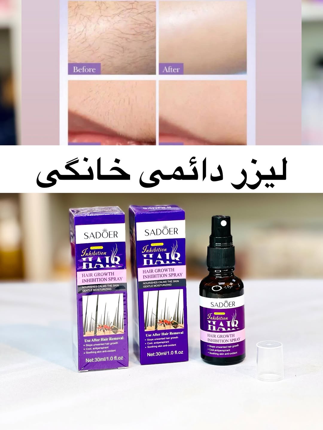 IMG_9870 اسپری روغن و عصاره حذف مو روغن مورچه صدرصد اورجینال - تصویر 1