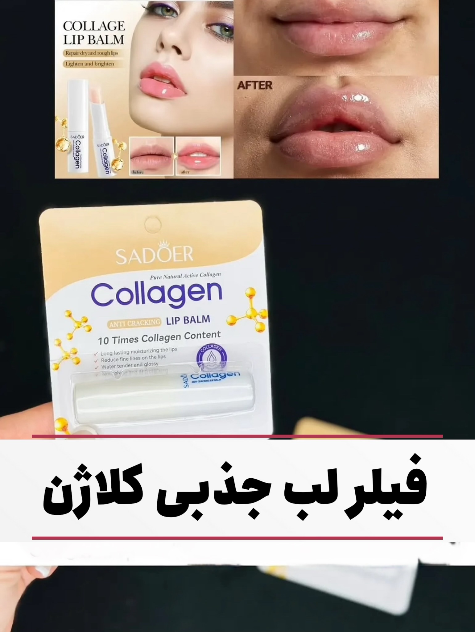 photo-output فیلر لب جذبی کلاژن - تصویر 1