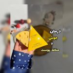 صابون ضد لک و ضدجوش پنیری MISTLETOE
