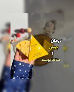 صابون ضد لک و ضدجوش پنیری MISTLETOE