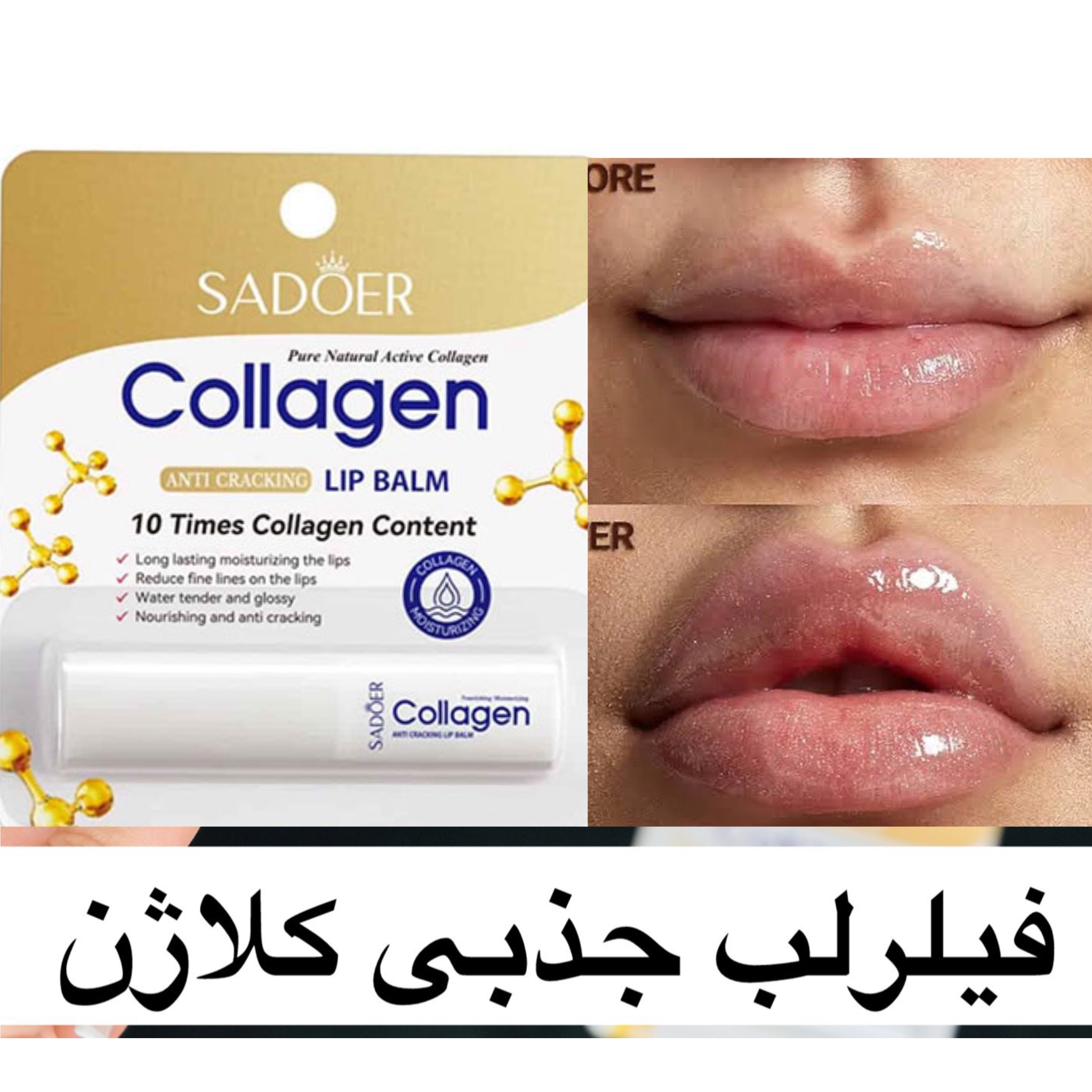photo-output فیلر لب جذبی کلاژن - تصویر 1
