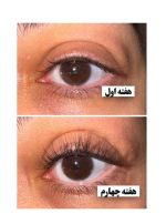 سرم تقویت مژه و ابرو لانبنا (اورجینال) - تصویر 5