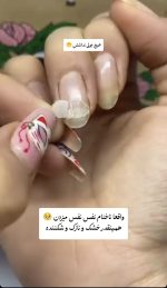 سرم تقویت کننده و ترمیم ناخن لانبنا | ضد قارچ، ترمیم ترک و رفع شکنندگی ناخن - تصویر 6